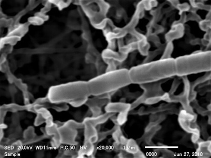 【異物・不良解析】走査電子顕微鏡（SEM-EDS）による表面形状観察・元素マッピング解析の画像3
