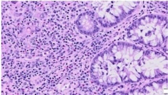 がん等臨床検体における発現解析の画像1