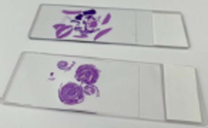 病理標本作製の画像1