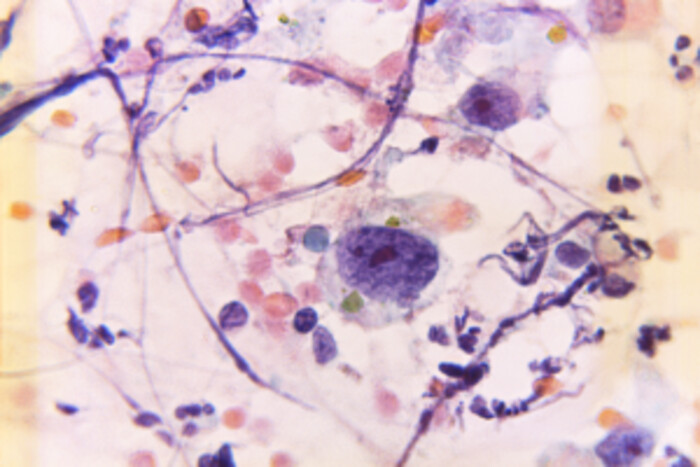 エクソソーム調製の画像1