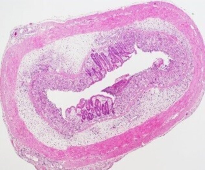 デキストラン硫酸ナトリウム誘発潰瘍性大腸炎モデルマウスを用いた評価試験の画像1